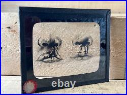 Antique (19) Medical GLASS SLIDES, PLASTIC SURGERY With Wood Carrying Case 1930s